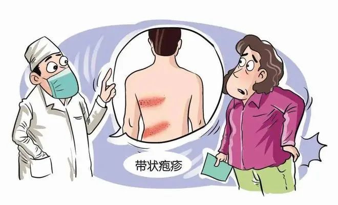 带状疱疹得一次就终身免疫？关于这个切肤之痛你了解多少